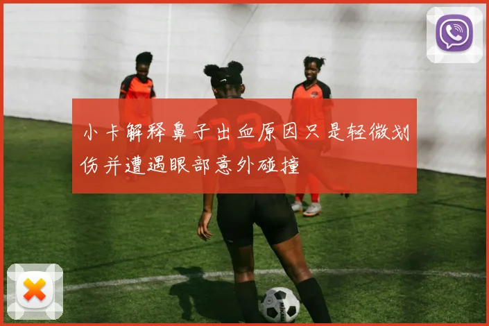 小卡解释鼻子出血原因只是轻微划伤并遭遇眼部意外碰撞